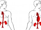 aneurysma-a-disekce-aorty2.jpg - kopie